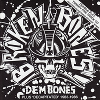 Wealth Rules - Broken Bones