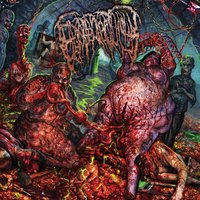Epicardiectomy