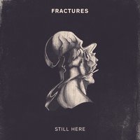 Lowcast - Fractures