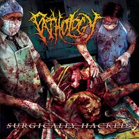 Impious Brain Donor - Pathology